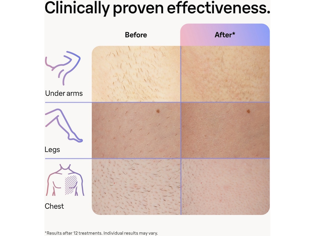 Braun Smart IPL Skin i·expert PL7253 (rosa) Epilator & IPL-hårfjerning