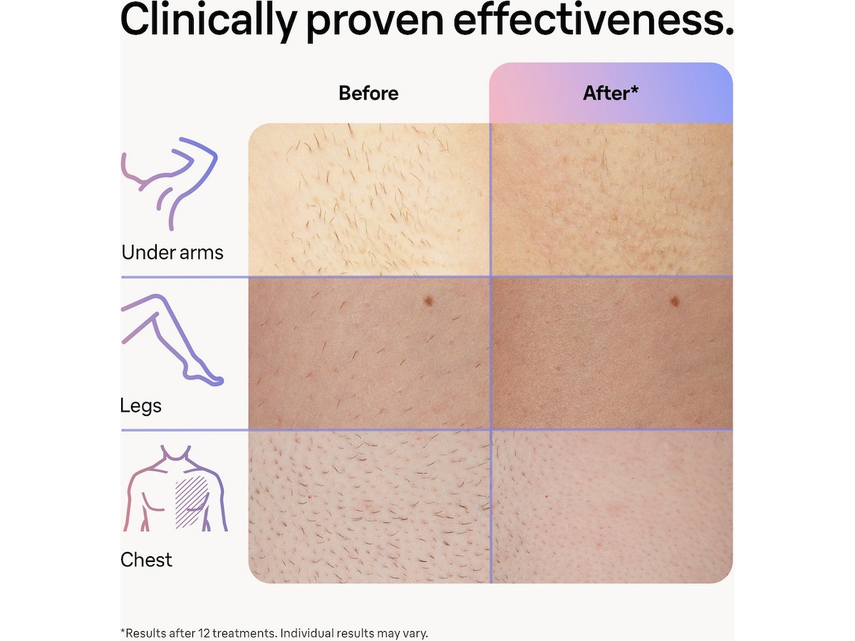 Braun Smart IPL Skin i·expert PL7253 (rosa) Epilator & IPL-hårfjerning