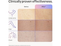 Braun Smart IPL Skin i·expert PL7253 (rosa) Epilator & IPL-hårfjerning