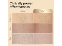 Braun IPL Silk·expert Pro 5 PL5242 (hvit/gull) Epilator & IPL-hårfjerning