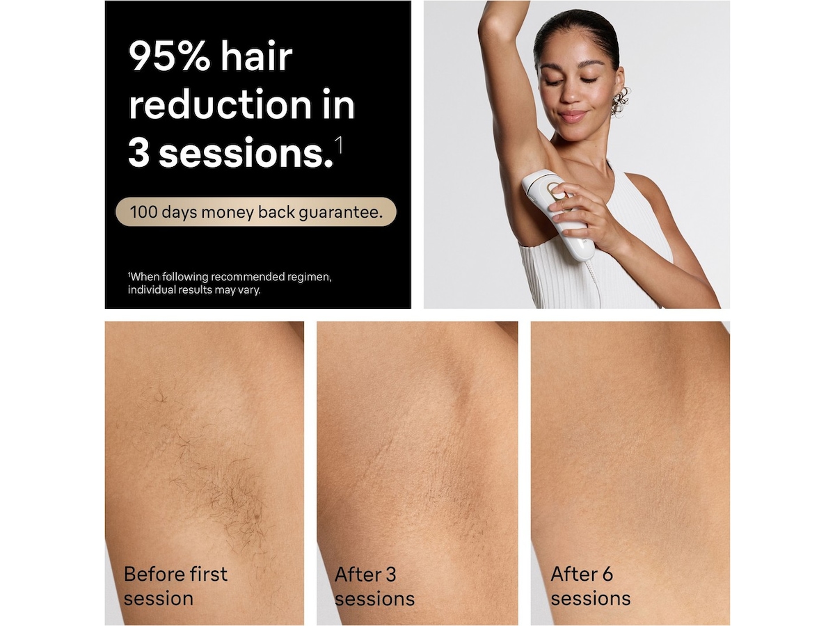 Braun IPL Silk-Expert Pro 5 Epilator & IPL-hårfjerning