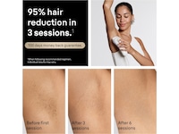 Braun IPL Silk-Expert Pro 5 Epilator & IPL-hårfjerning