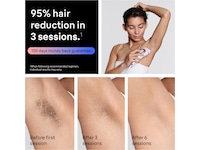 Braun IPL Skin i·expert PL7431 Epilator & IPL-hårfjerning